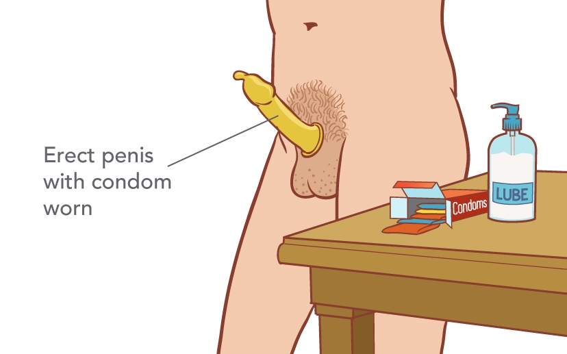 Condom On Erect Penis