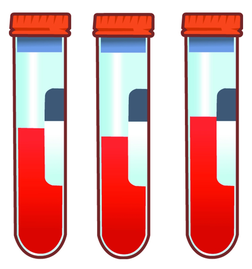 Test Tubes With Blood